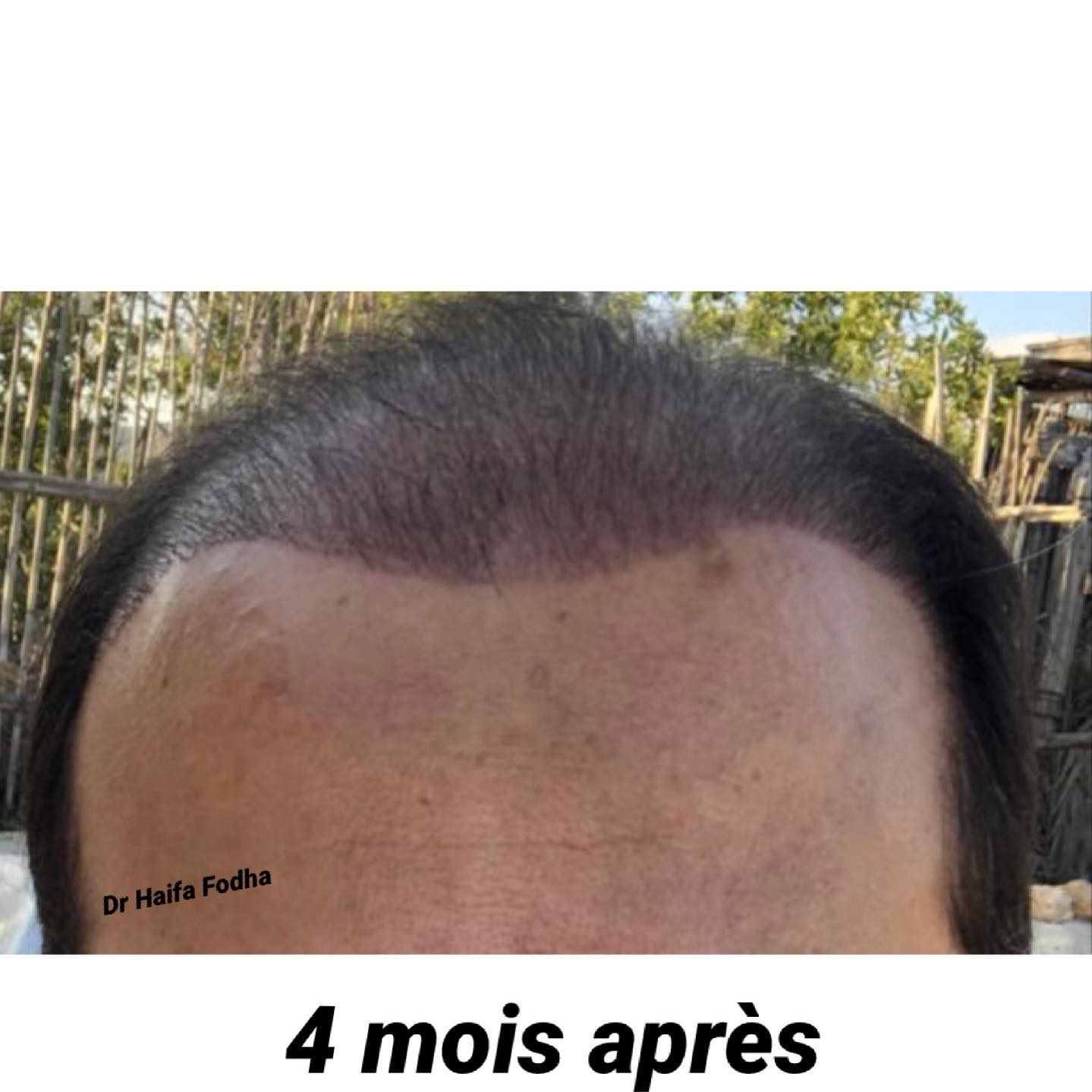 Depuis Instagram