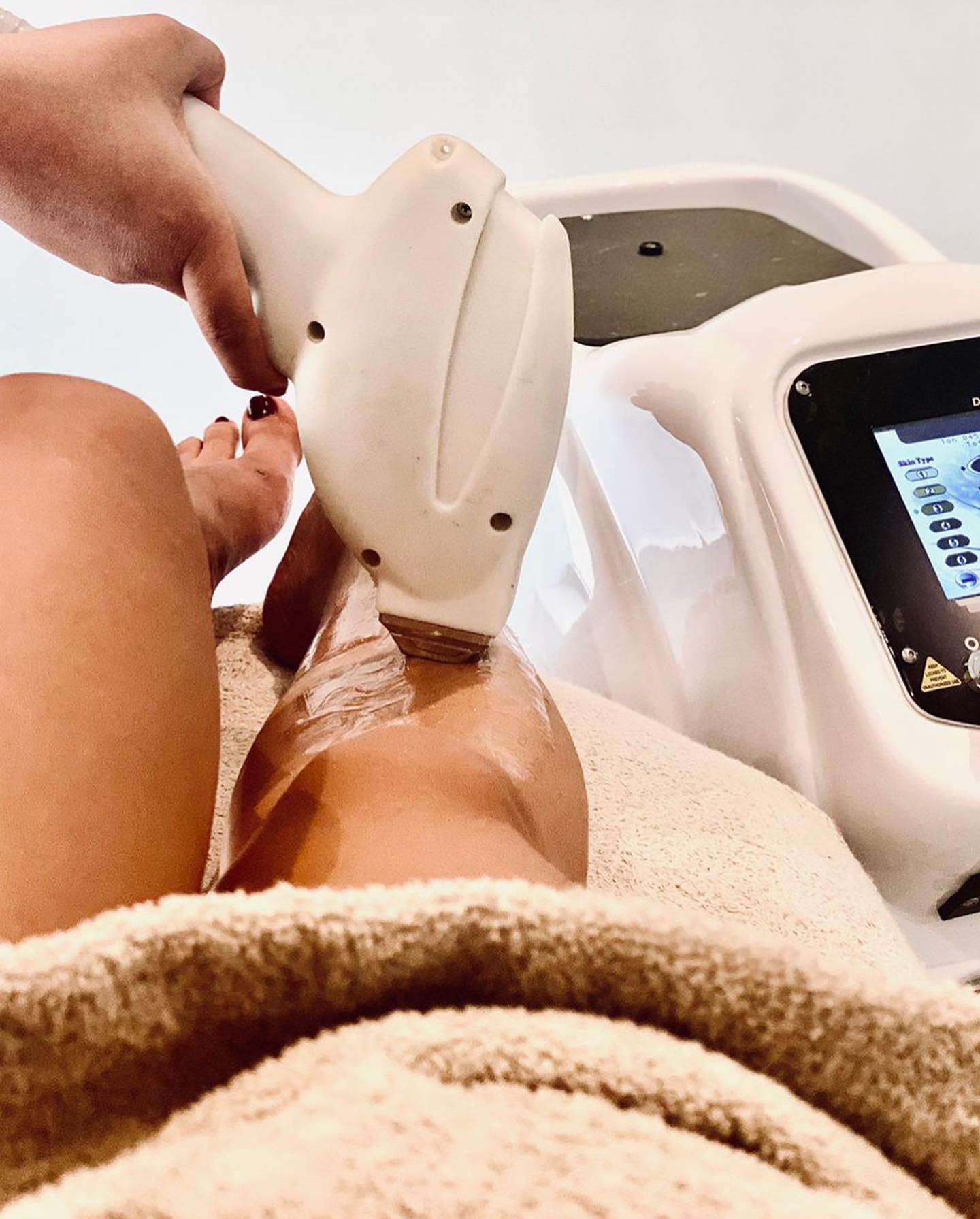 L'épilation au laser diode est un traitement efficace pour l'élimination des poils sur toutes les zones du corps.