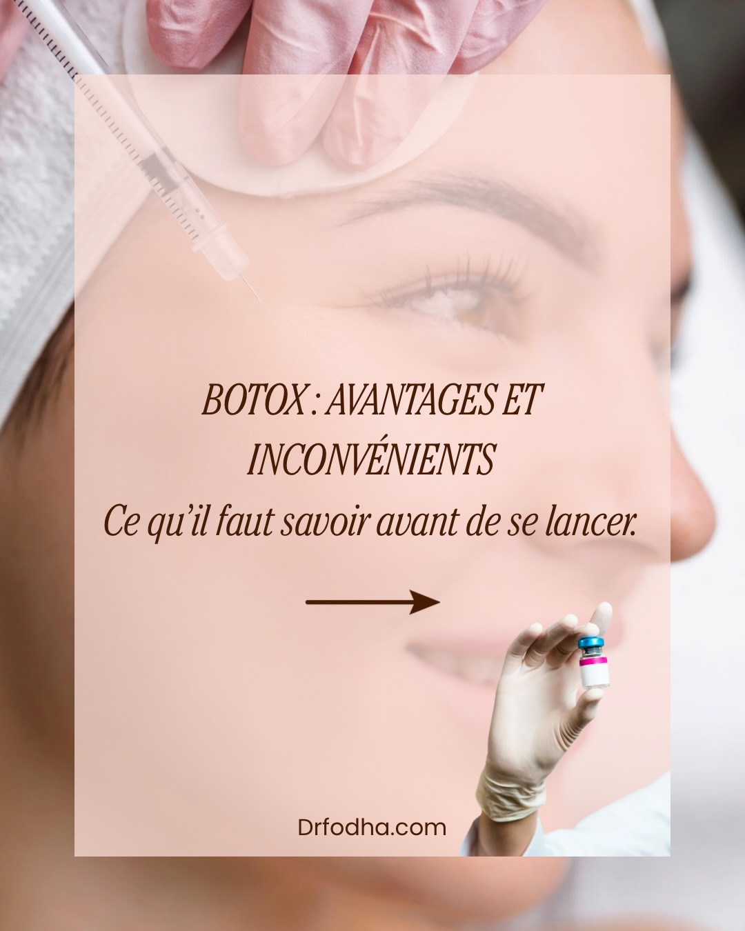 Le Botox présente des avantages et des inconvénients à considérer avant de choisir ce traitement esthétique.