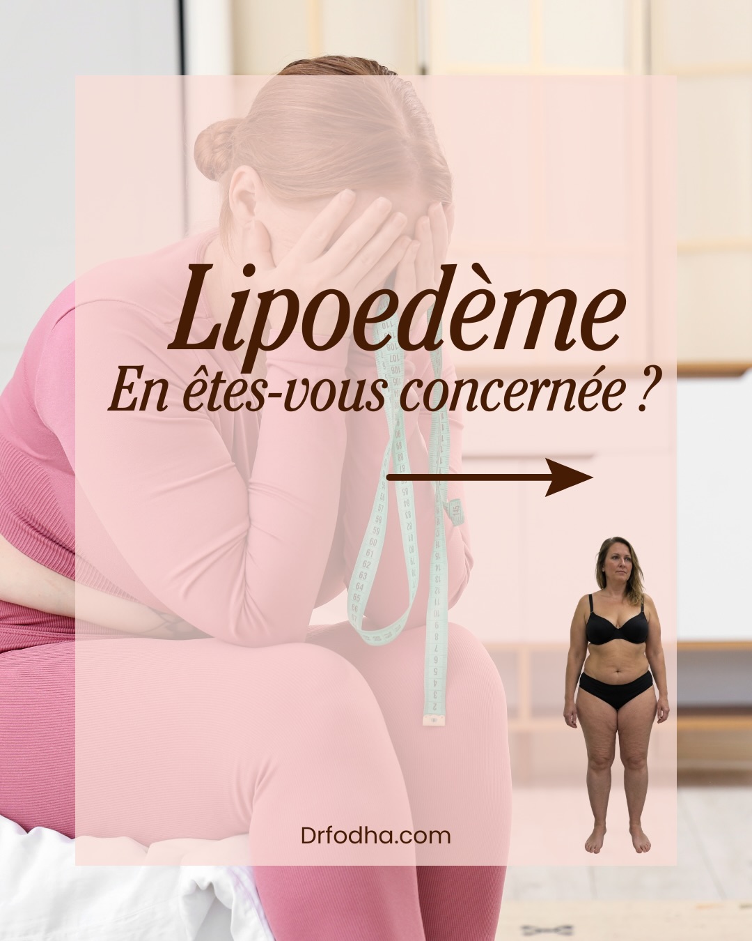 Ce post présente des informations sur le lipoedème et propose un guide complet pour ceux qui souhaitent en savoir plus.
