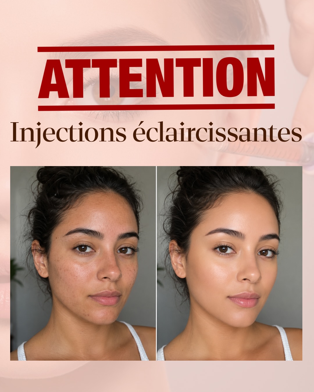 Cette image présente une transformation du teint grâce aux injections éclaircissantes.